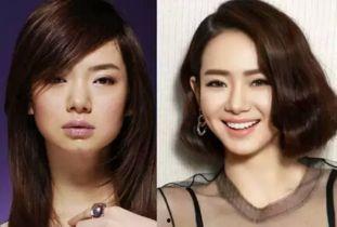 女明星有尖下巴,美丽与魅力的完美融合